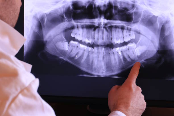 Best Broken or Cracked Tooth Emergency Dentist in Mount Gilead, NC
