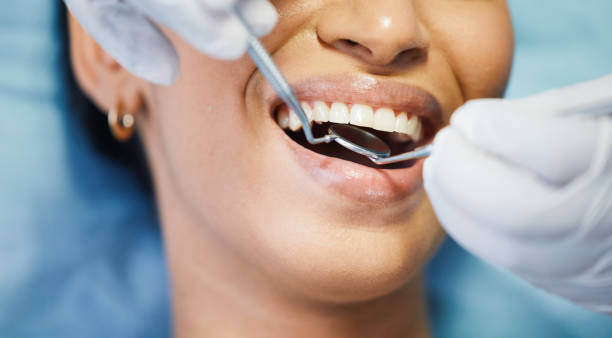 Best Emergency Dentist for Lost Fillings or Crowns in Mount Gilead, NC